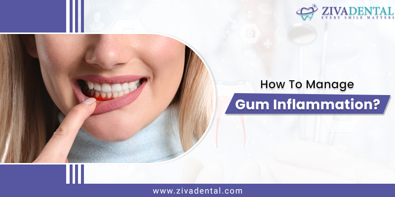 Gum disease Inflammation treatment